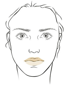 Botox Göttingen Lip Flip