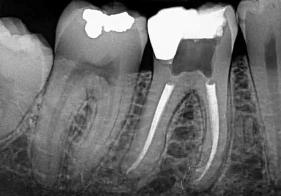 X-ray1560x390.webp