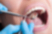 Teeth Cleaning Near Me in Richmond