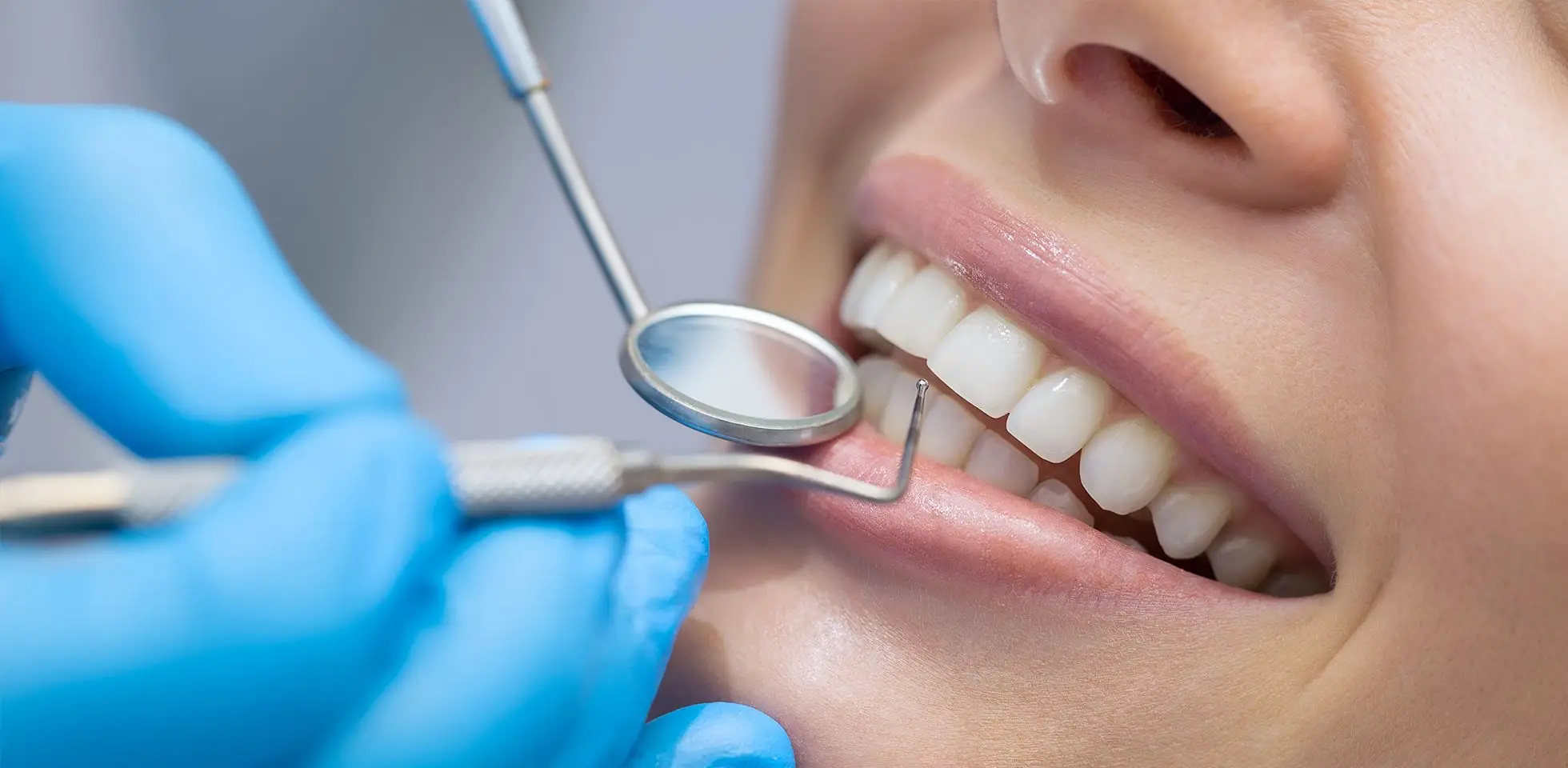 photo-service-dentalcleaning.webp