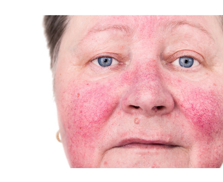 Untitled design (84).png