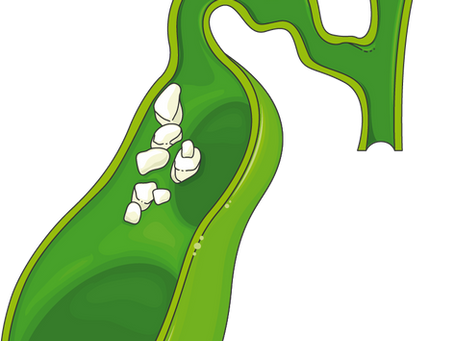 Do Gallstones Appear In Women Over 40?