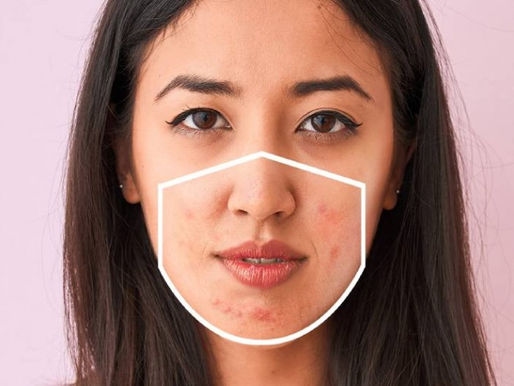 Skincare: Under The Mask