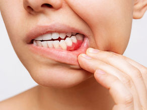 Gum Disease In Lansdale: Early Signs, Prevention, And Comfortable Treatment