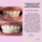 Beige Modern Business Testimonial Instagram Portrait Post (Instagram Post).jpeg