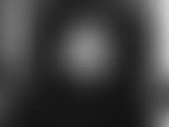 Caparezza: “Vivo con gli Apparecchi Acustici”