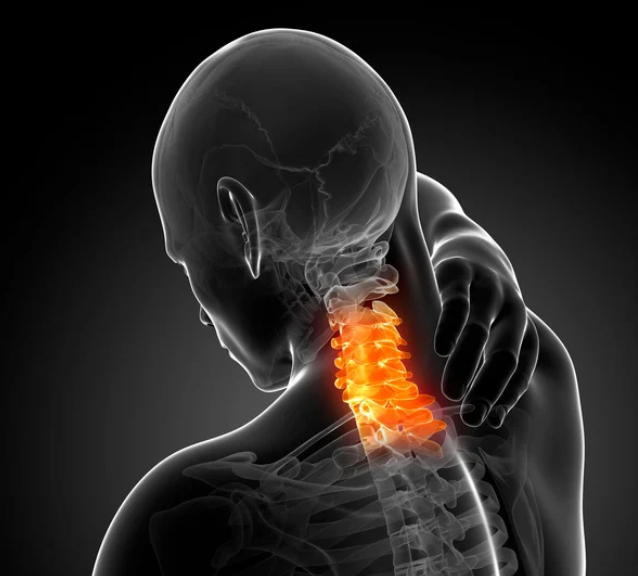 figure of person with spine showing, neck - cervical spine - is orange/red in color indicating pain, with person's right hand up near the painful neck