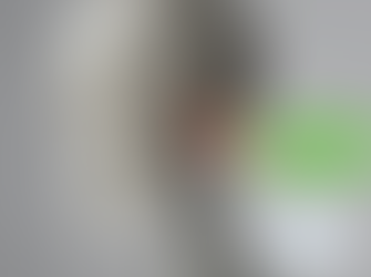 Let's Talk Temporomandibular Joint Dysfunction (TMD)