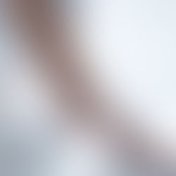 Dry skin – What is it, what causes it, and what can be done about it?