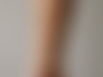 An arm with an ugly scar.