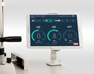 Laser φωτοπηξίας  (2).jpg