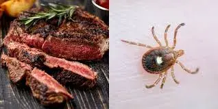 The Carnivorous Conundrum: Unmasking Alpha-Gal Syndrome