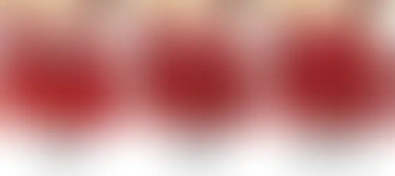 Is it true that I need antibiotics prior to dental work if I have Mitral Valve Prolapse?