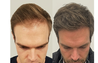 Lawyer before and after_edited.png