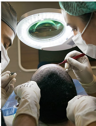 hair transplant in pogress.png
