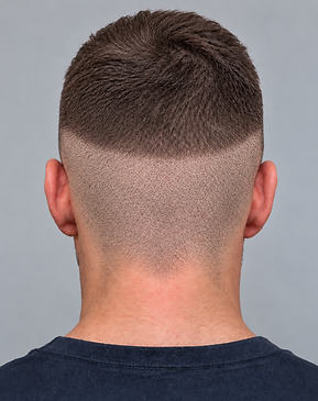 donor fully shaven.png