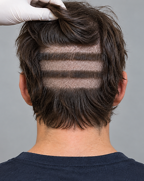 line shave.png