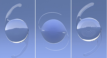 cataract surgery lens implants
