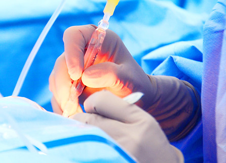 cataract surgery eye care specialists milwaukee