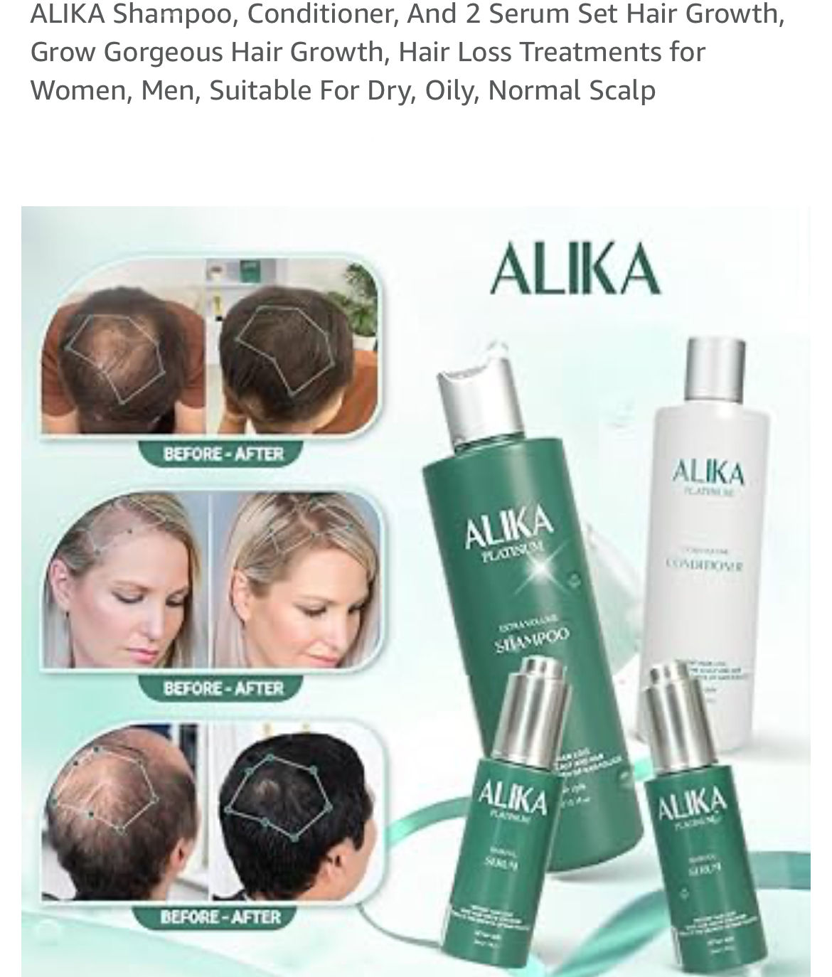 防脱发增发洗发套装