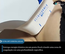 2023 - Base Catálogo  Tecnologias CR Laser®  (3).png