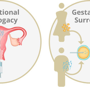 Diagram showing Traditional Surrogacy with uterus and insemination, and Gestational Surrogacy with IVF process. Labels indicate each type.