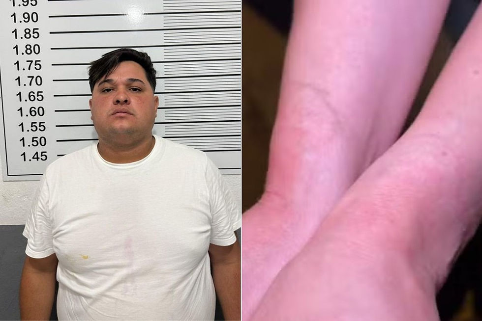 Lucas Thiago Freitas dos Santos foi preso suspeito pelo sequestro; à direita, as marcas no pulso da mulher que ficou amarrada. — Foto: Polícia Civil e Reprodução/TV Tribuna.