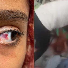 Menina é espancada por adolescente em sala de escola estadual no litoral de SP