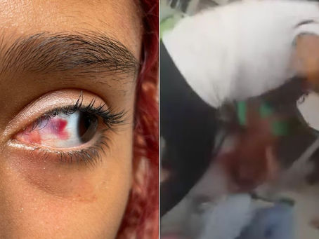 Menina é espancada por adolescente em sala de escola estadual no litoral de SP