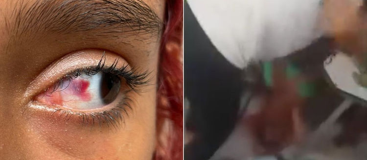 Menina é espancada por adolescente em sala de escola estadual no litoral de SP