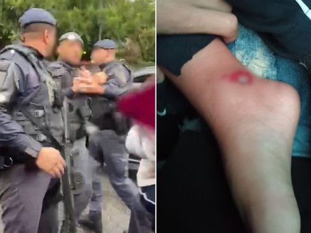 Menino de 3 anos é atropelado por viatura ao sair da creche e PM ameaça família no litoral de SP