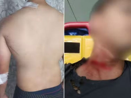 Motociclista que se acidentou após se enroscar em fiação em Santos, SP, será indenizado.