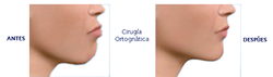 Cirugia Maxilofacial