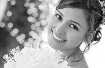 Wedding-Smile-Makeover-2-215x140.jpg