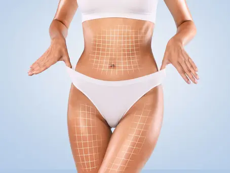 What Are the Different Types of Professional Body Sculpting?
