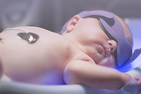 Newborn baby going through a phototherapy session