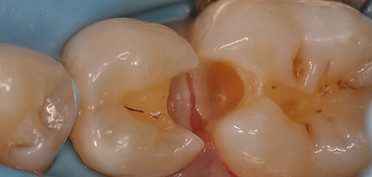 AFCD81E2-EF73-4BED-9EC3-13E5B5B6FBE7_1_2