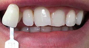 3657F880-355C-4CC8-8289-761496C74EA1_1_2