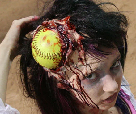 softball-wound-prosthetic