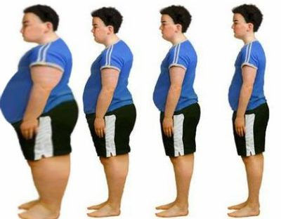 Childhood Obesity