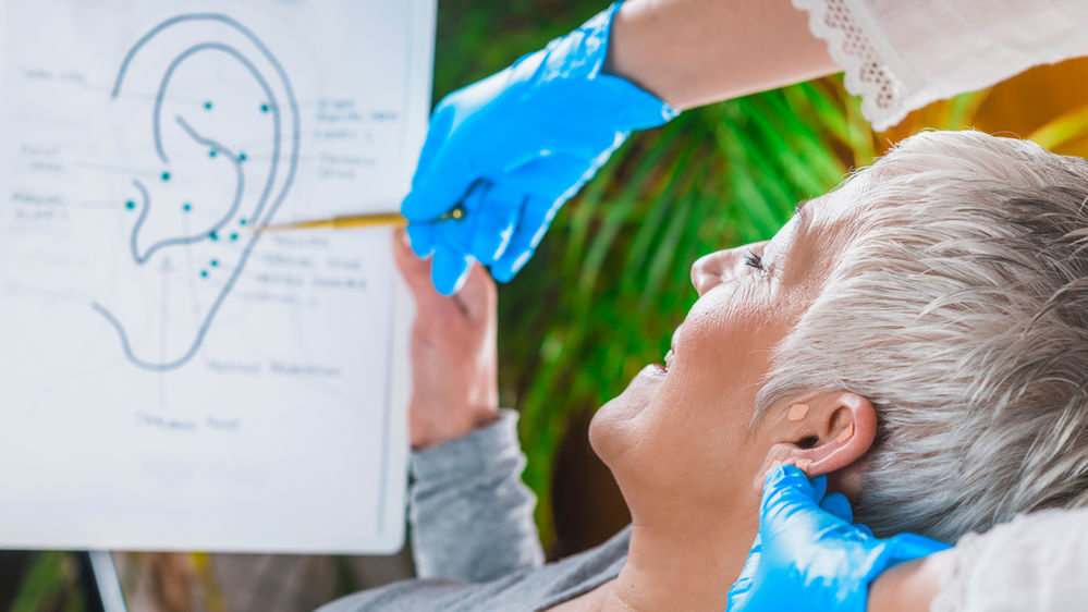 Auricular Acupuncture for Weight Loss