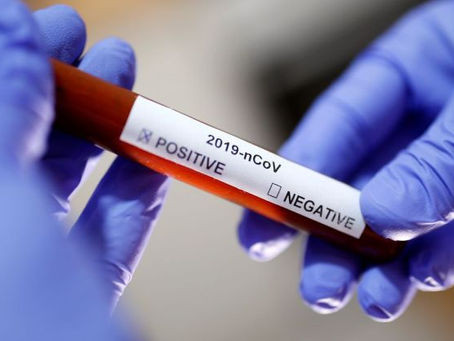 SOBE PARA SETE O NÚMERO DE CASOS ATIVOS DE COVID-19 NO CONCELHO DE RIO MAIOR