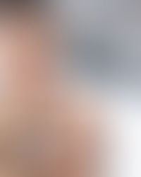 🚺 Mulheres e Lesões: Quais São as Mais Comuns e Como Prevenir? 🤕💪