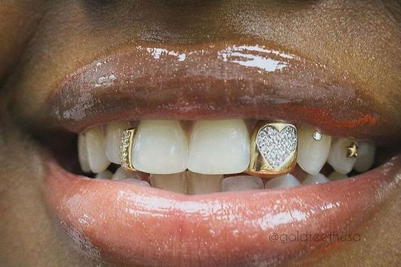Accesorios que son tendencia : Joyas para dientes