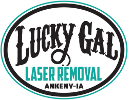 Lucky Gal Laser Removal logo Ankeny, Iowa