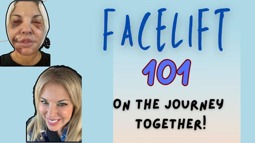 Facelift 101 Facebook Group cover