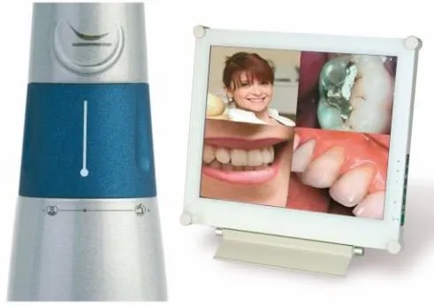 SOPRO intraoral camera