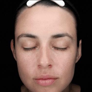 Skin-Ageing.gif