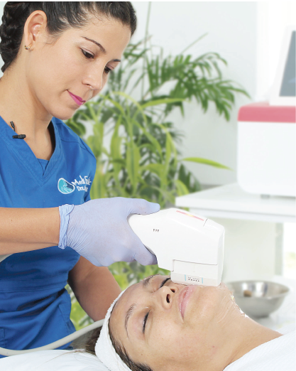 Ultralift HIFU