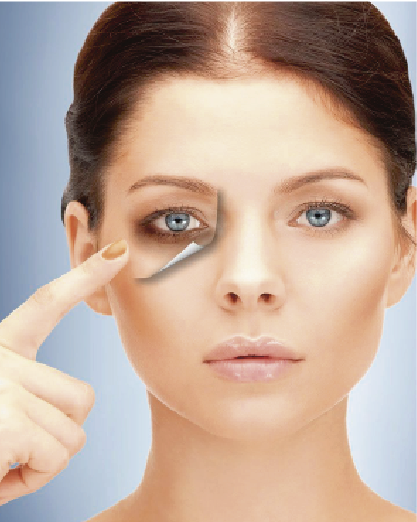 Peeling Ojeras